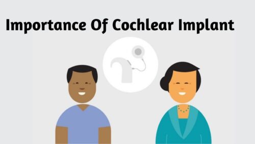 Cochlear Implant importance